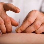 Acupuncture Medical Treatments