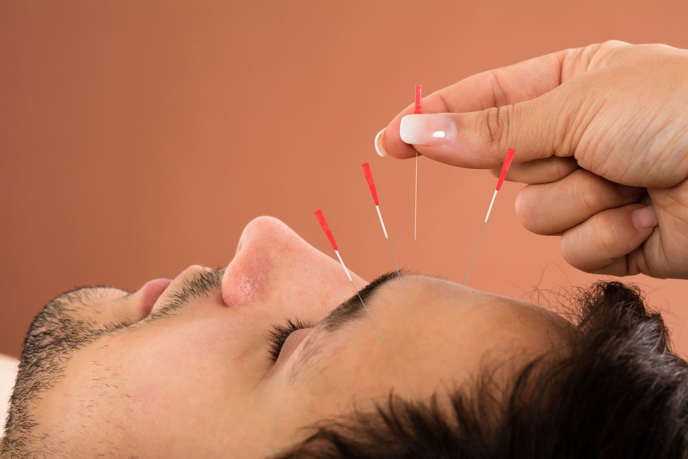 Acupuncture Treatment for Insomnia - Accurate Acupuncture