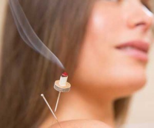 Moxibustion treatment available at Accurate Acupuncture AZ