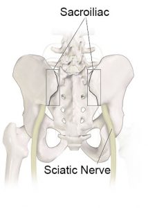 Illustration of hip bone showing sciatic nerve, Accurate Acupuncture, Phoenix AZ 